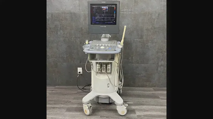 Siemens Acuson X150 Ultrasound: Equipment for Doctors and Clinics || Angelus Medical